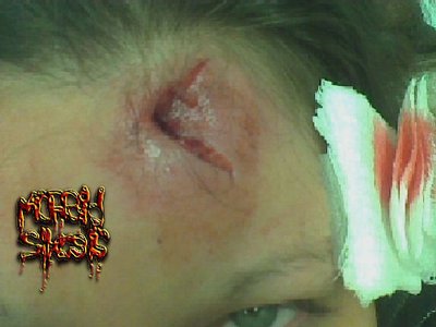 Morbid Sikosis photo