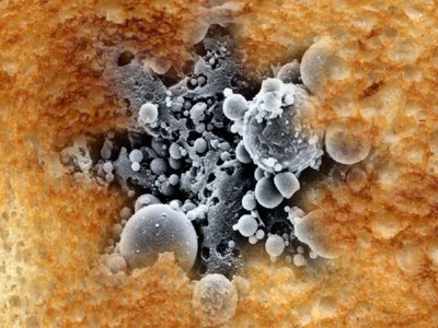 Toast Particulates (2011)