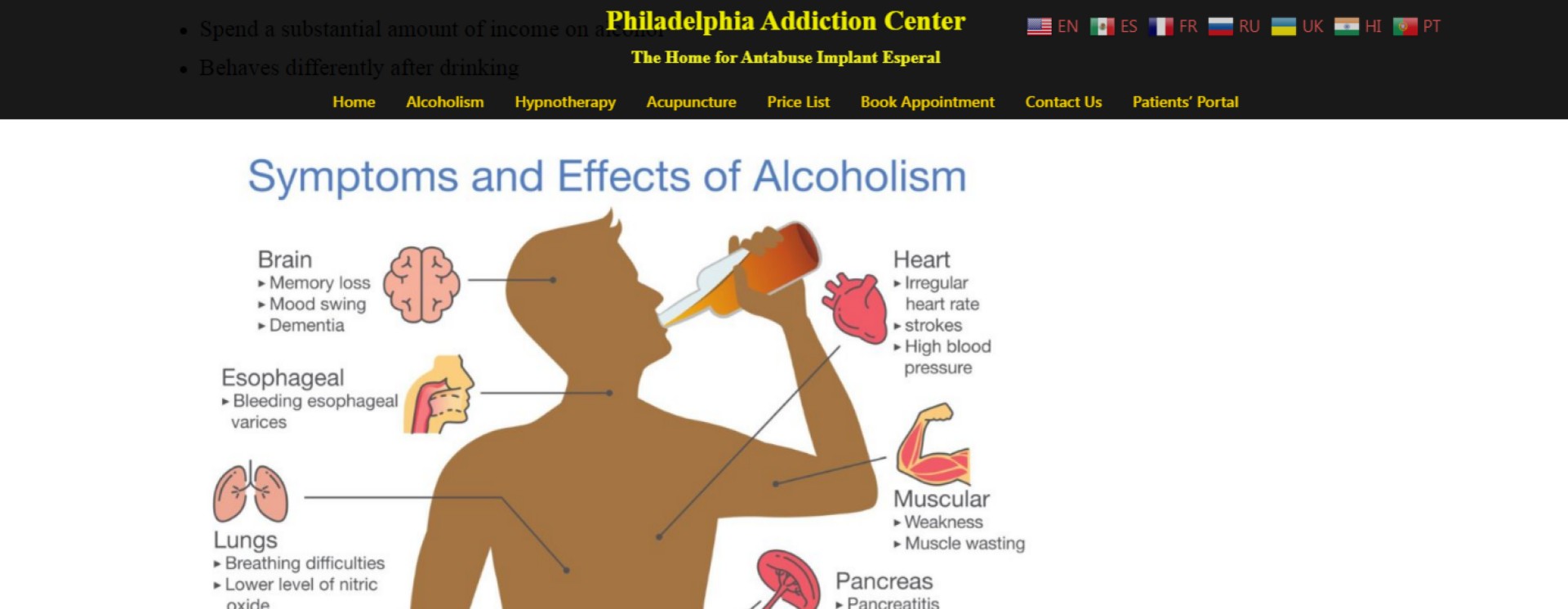 ReverbNation banner for @alcoholism